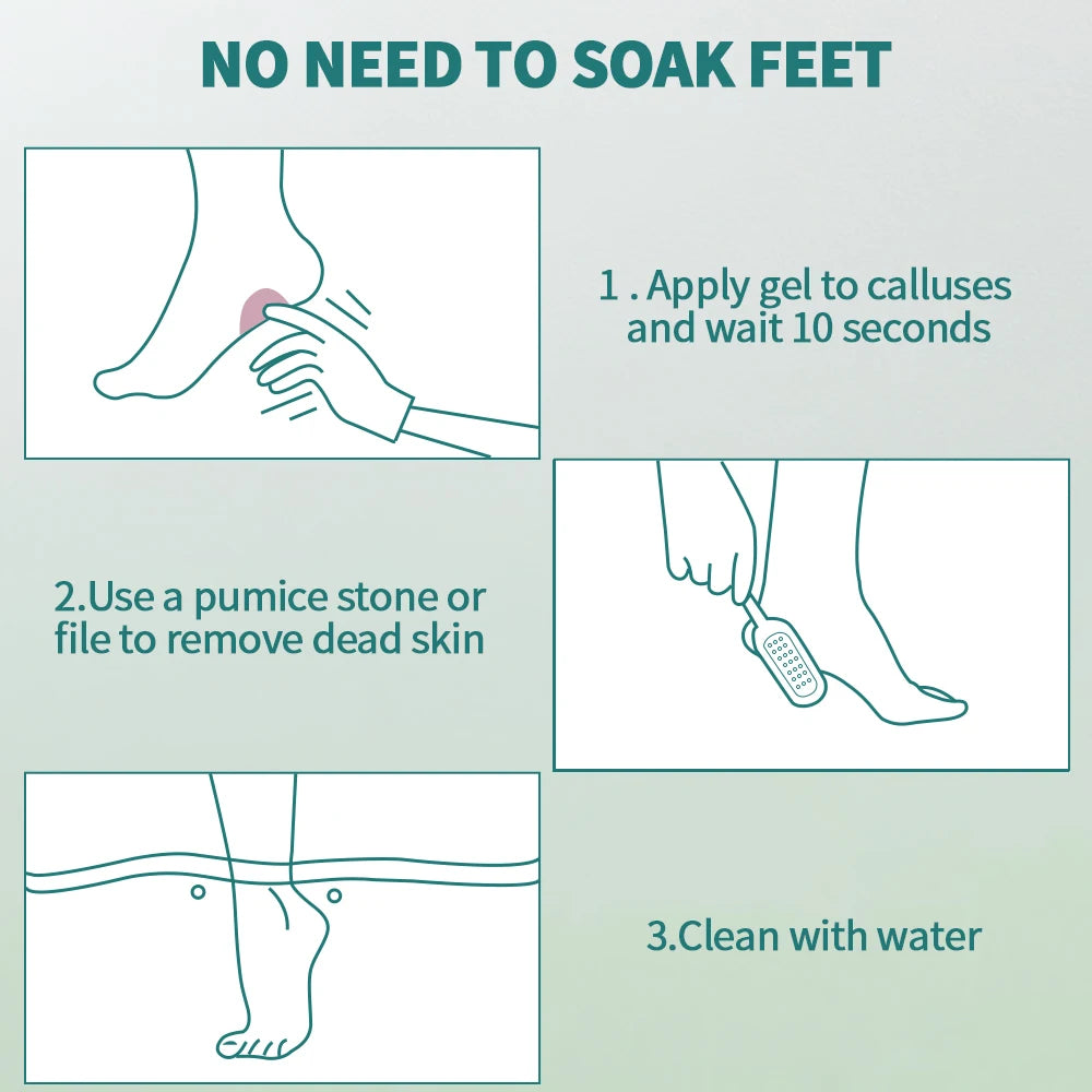 Kit dissolvant de callosités professionnel pour pieds, gel extra résistant, lime et accessoires pour talons secs et peau morte