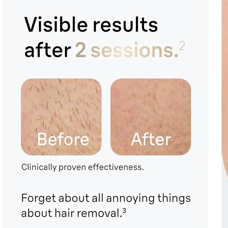 Épilateur Laser IPL pour Femmes – 999 999 Flashs, Épilation Indolore pour Bikini, Visage et Corps, Usage Domestique