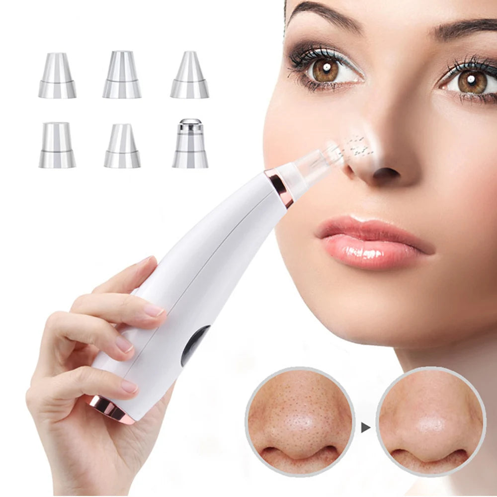 Acne Cleaner, Blackhead Removal, Deep Face Cleaning, Pore Cleaner, Skin Care Tools