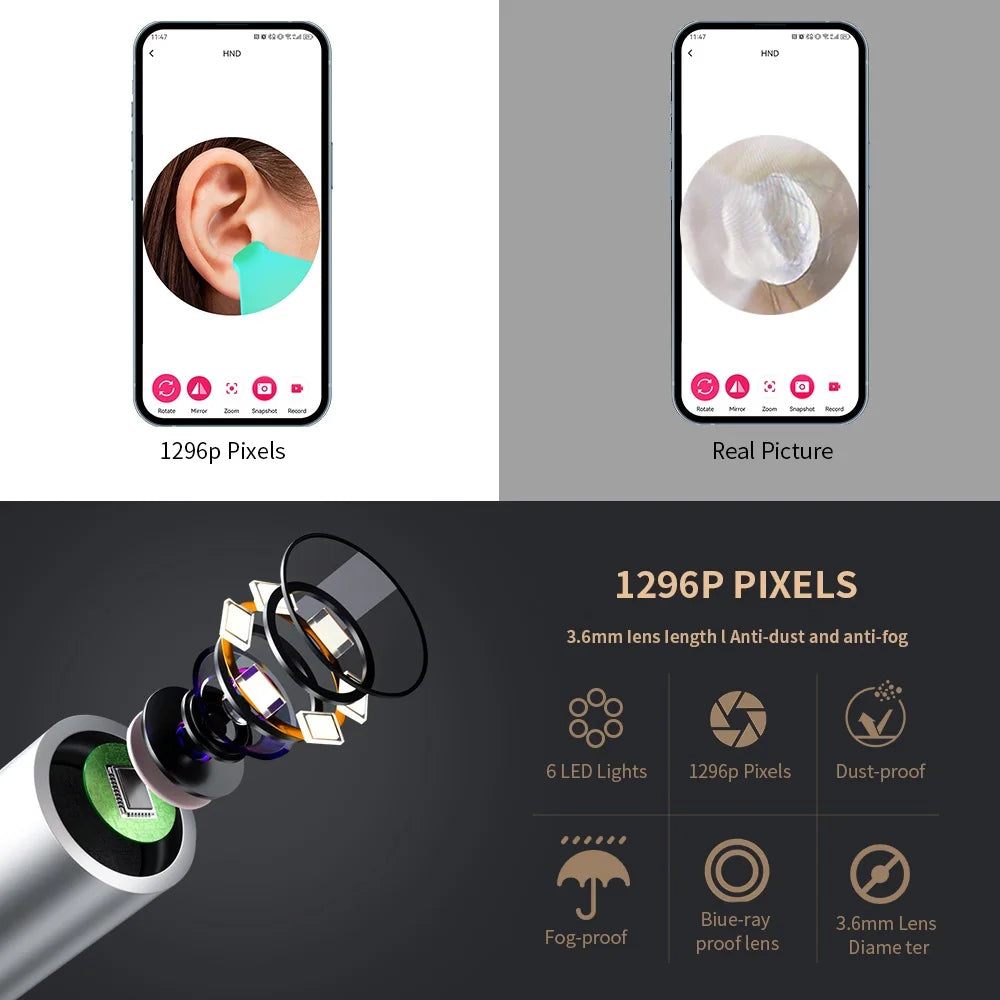 Nettoyeur d'oreille visuel intelligent avec caméra 1296P, bâtons d'oreille, chargement USB C, connexion WiFi, 6 lumières LED, cure-oreille